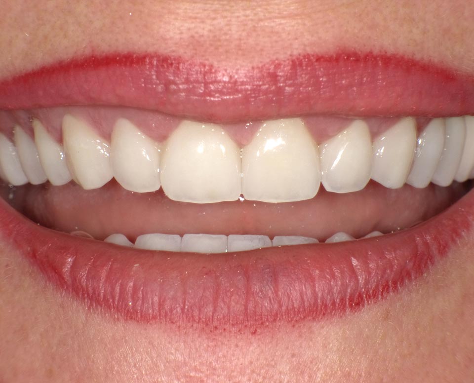 Vorher-Nachher Bilder