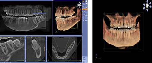 Dres. Dwornik & Classen, Zahnarzt, Master of Science Implantologie und Zahnärztin in Jülich / Düren: 3D-Röntgen / DVT mit Sirona Orthophos XG 3D